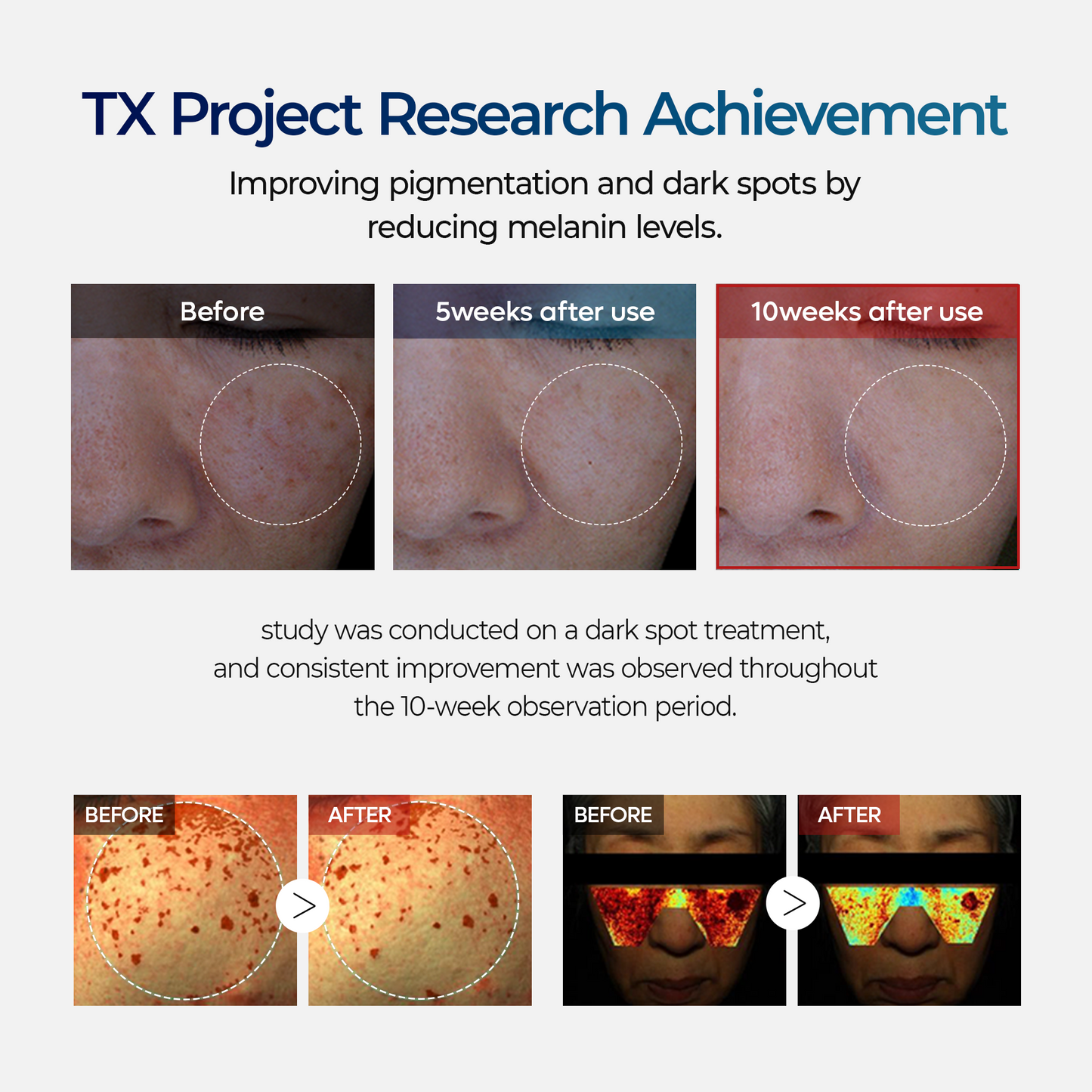 TX Dark Spot Cream
