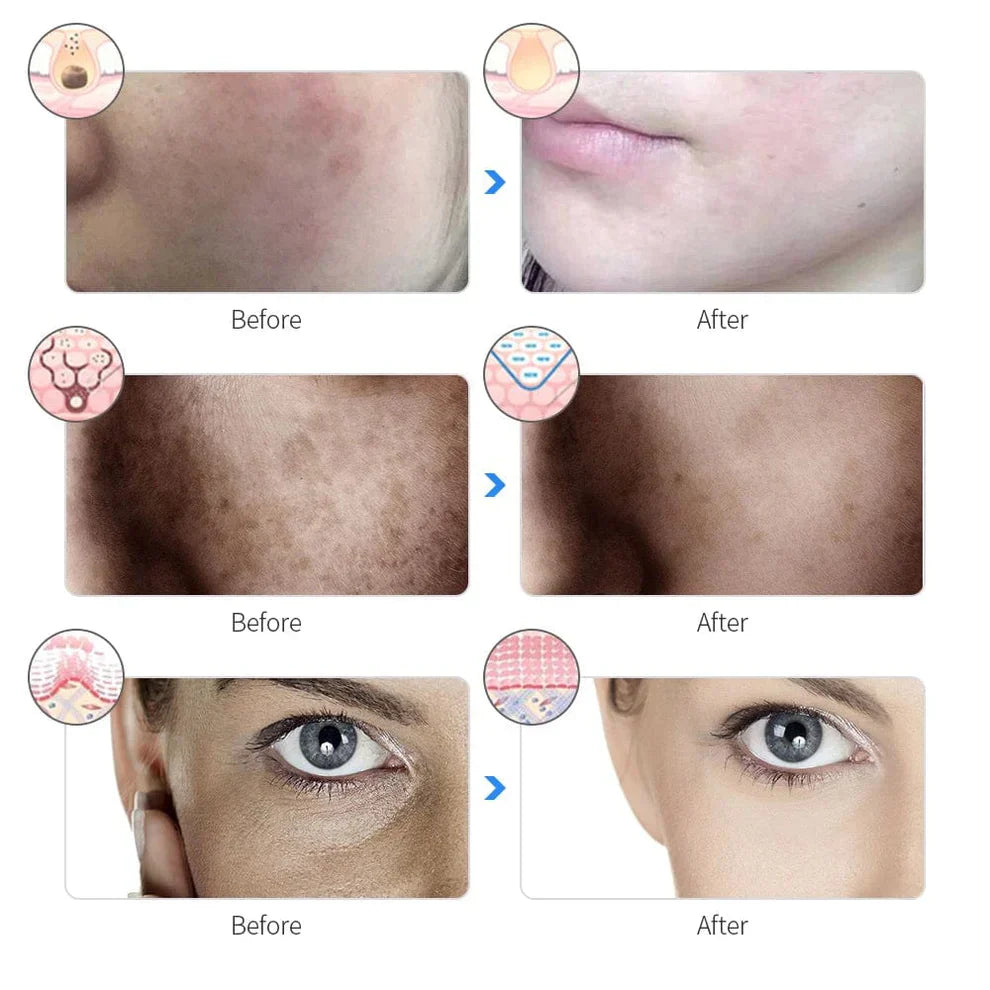 Red Therapy Facial Mask