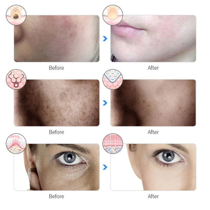 Red Therapy Facial Mask